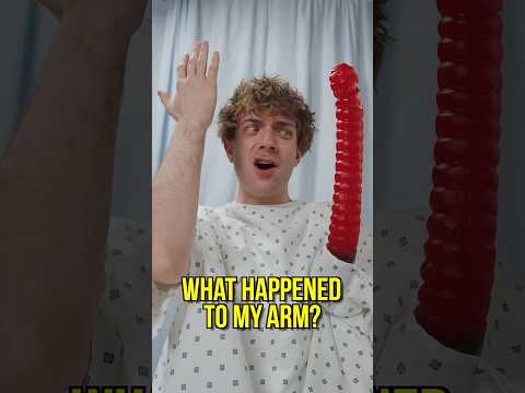 What Happened To My Arm?!